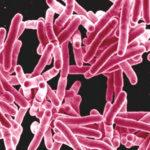 Alertan por un caso de tuberculosis en el ámbito educativo