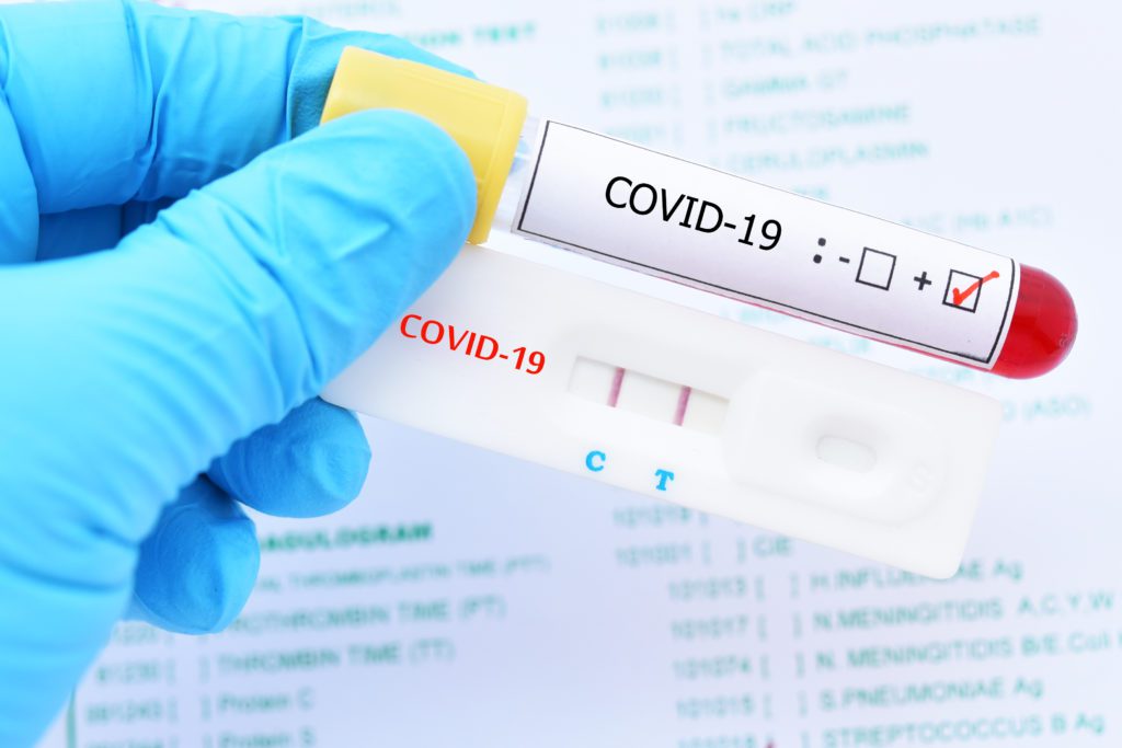 Suba de casos de Covid-19 en la Provincia: “En los últimos 7 días fue del 100%”