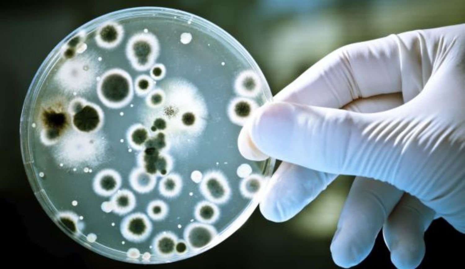 En Magdalena no hay casos de intoxicaciones alimentarias por achuras o cárnicos